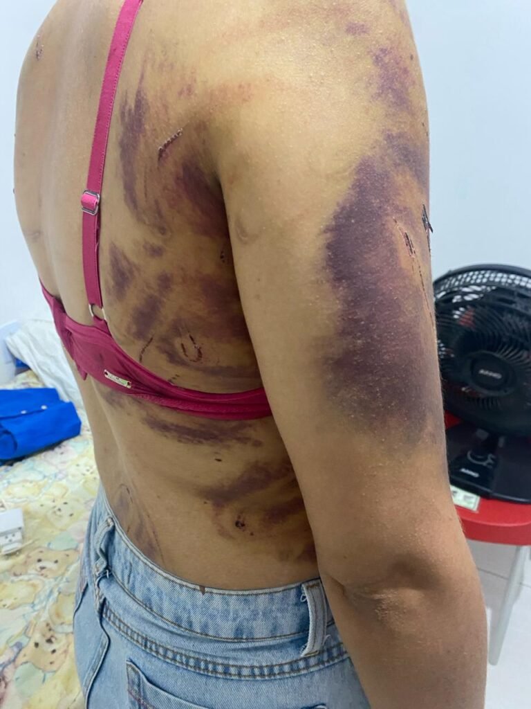 Lavagem De Dinheiro – Prefeito De São José De Caiana é Investigado Por Pagamentos Irregulares A Empresa Envolvida Em Fraudes Licitatórias